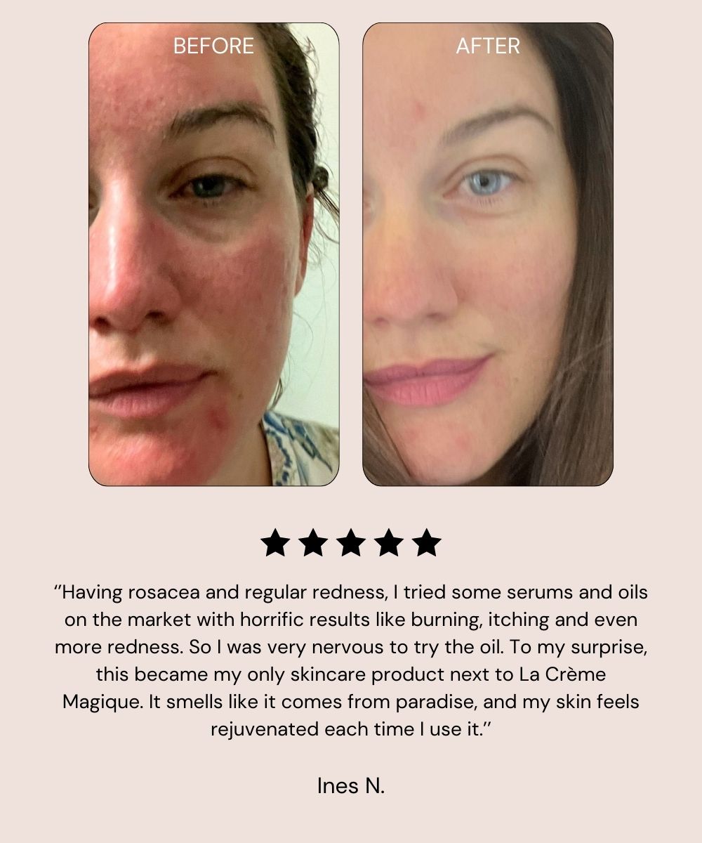 Visible results with Absolute Berry Bio-Retinol Face Oil – smoother and firmer skin