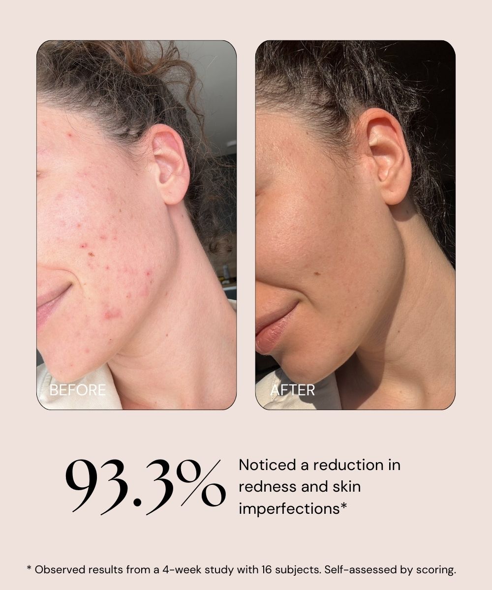 ABSOLUTE BERRY Ulje za Lice sa Bio-Retinolom