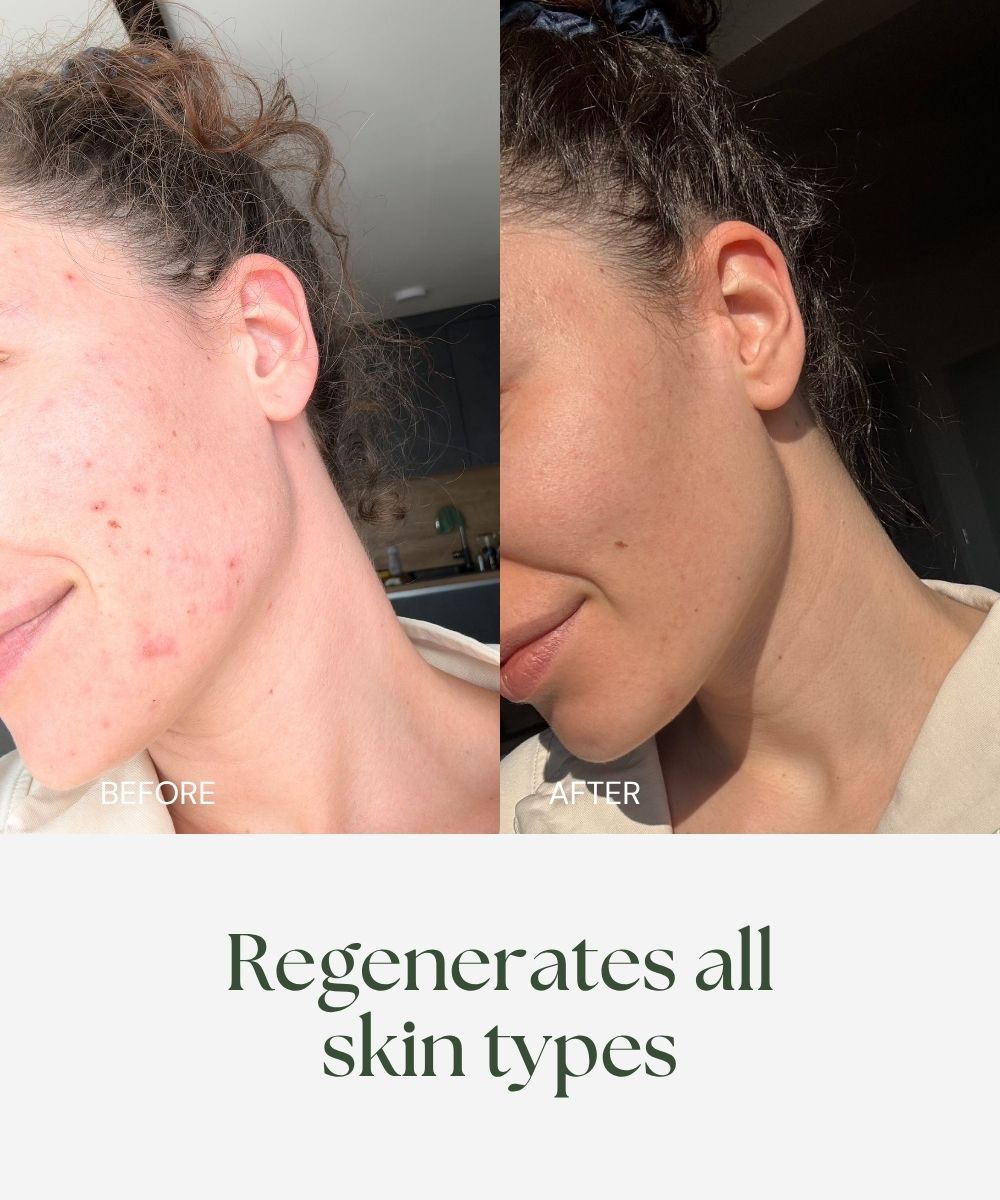 ABSOLUTE BERRY Bio Retinol Face Oil